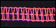 Black/Neon Pink